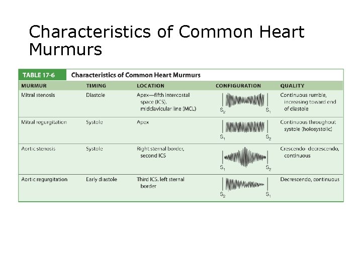 Characteristics of Common Heart Murmurs 