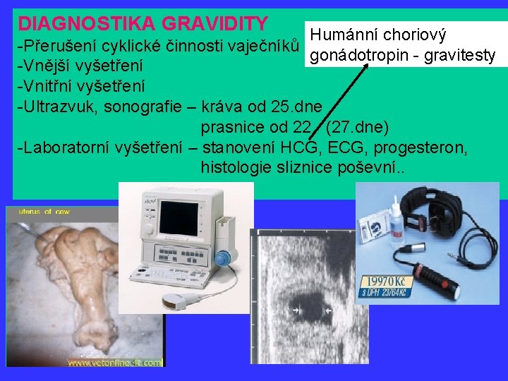 DIAGNOSTIKA GRAVIDITY Humánní choriový -Přerušení cyklické činnosti vaječníků gonádotropin - gravitesty -Vnější vyšetření -Vnitřní