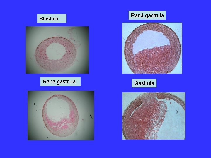 Blastula Raná gastrula Gastrula 