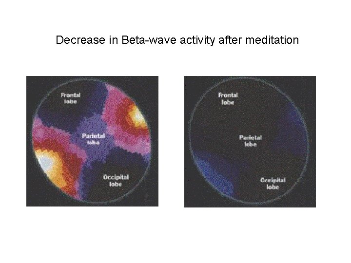 Decrease in Beta-wave activity after meditation 