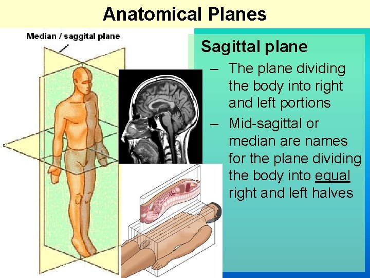 Anatomical Planes Sagittal plane – The plane dividing the body into right and left