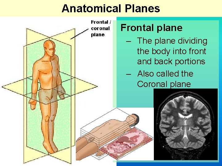 Anatomical Planes Frontal plane – The plane dividing the body into front and back