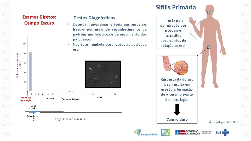 Sífilis Primária Exames Diretos: Campo Escuro Momento da infecção Semanas Testes Diagnósticos • Detecta