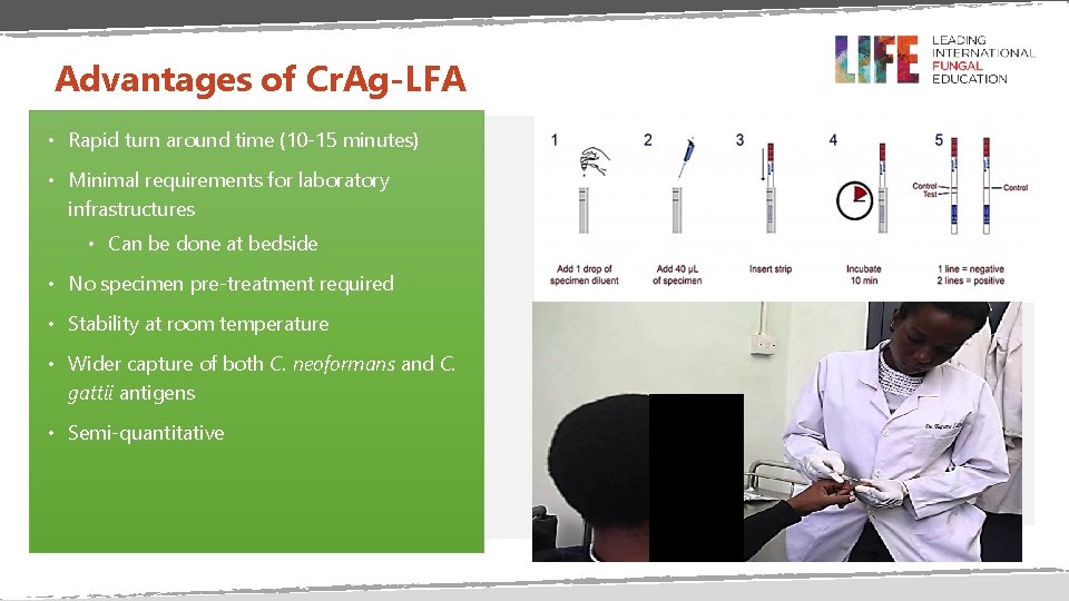 Diagnosis of Cryptococcal disease Professor Malcolm D Richardson