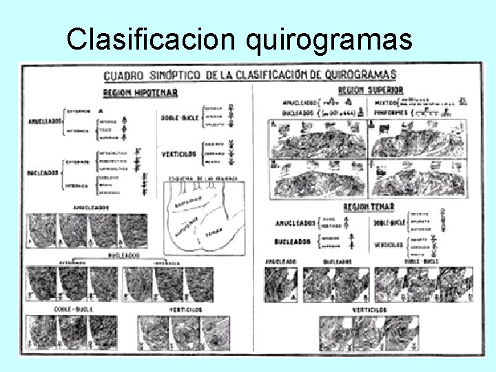 Clasificacion quirogramas 