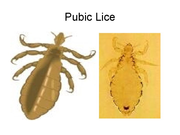 Pubic Lice 
