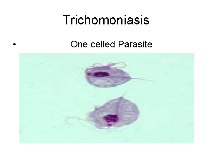 Trichomoniasis • One celled Parasite 