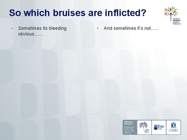 So which bruises are inflicted? • Sometimes its bleeding obvious…… • And sometimes it’s