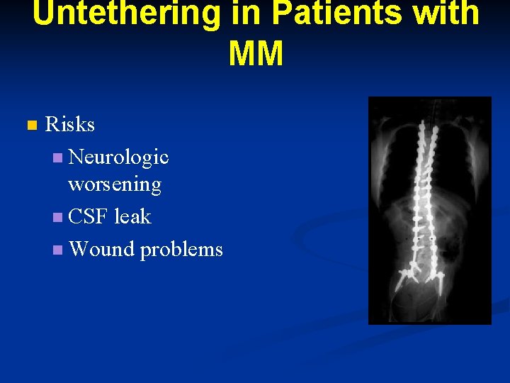 Untethering in Patients with MM n Risks n Neurologic worsening n CSF leak n Untethering in Patients with MM n Risks n Neurologic worsening n CSF leak n