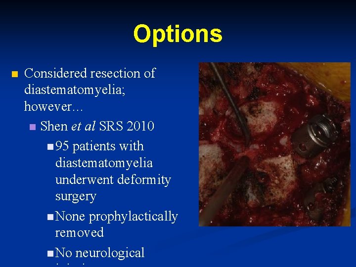 Options n Considered resection of diastematomyelia; however… n Shen et al SRS 2010 n Options n Considered resection of diastematomyelia; however… n Shen et al SRS 2010 n