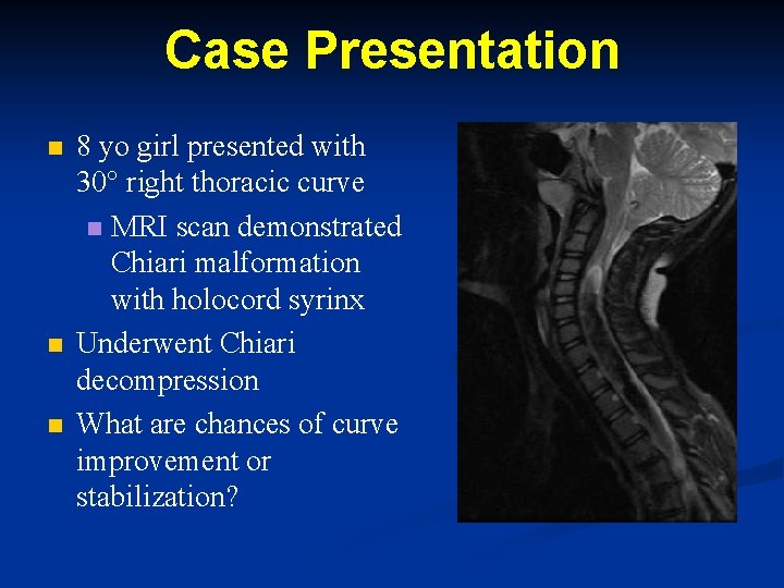 Case Presentation n 8 yo girl presented with 30° right thoracic curve n MRI Case Presentation n 8 yo girl presented with 30° right thoracic curve n MRI