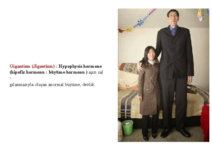 Gigantism (Jigantizm) : Hypophysis hormone (hipofiz hormonu : büyüme hormonu ) aşırı sal gılanmasıyla