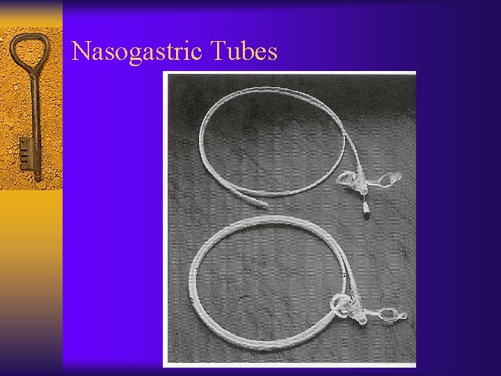 Nasogastric Tubes 