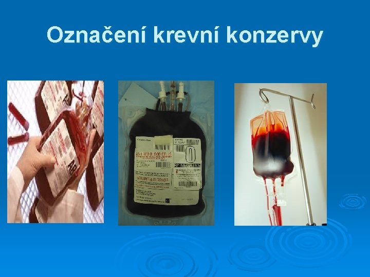 Označení krevní konzervy Označení krevní konzervy