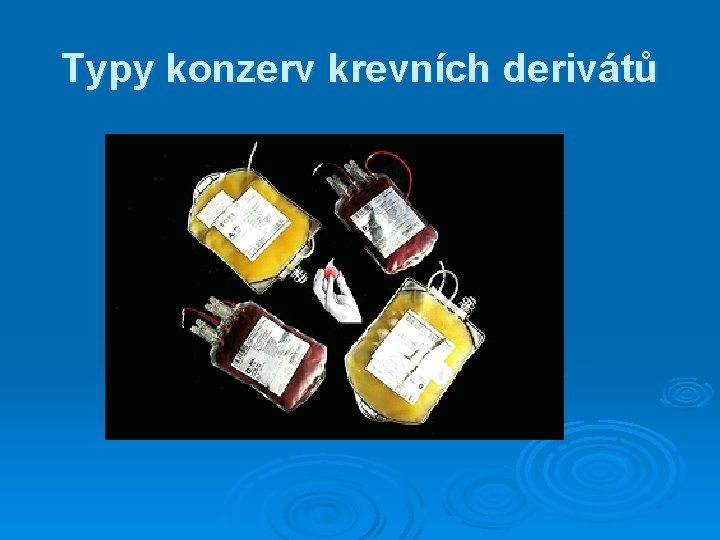 Typy konzerv krevních derivátů Typy konzerv krevních derivátů