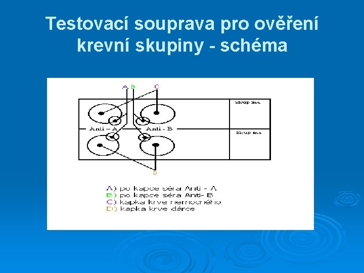 Testovací souprava pro ověření krevní skupiny - schéma Testovací souprava pro ověření krevní skupiny - schéma