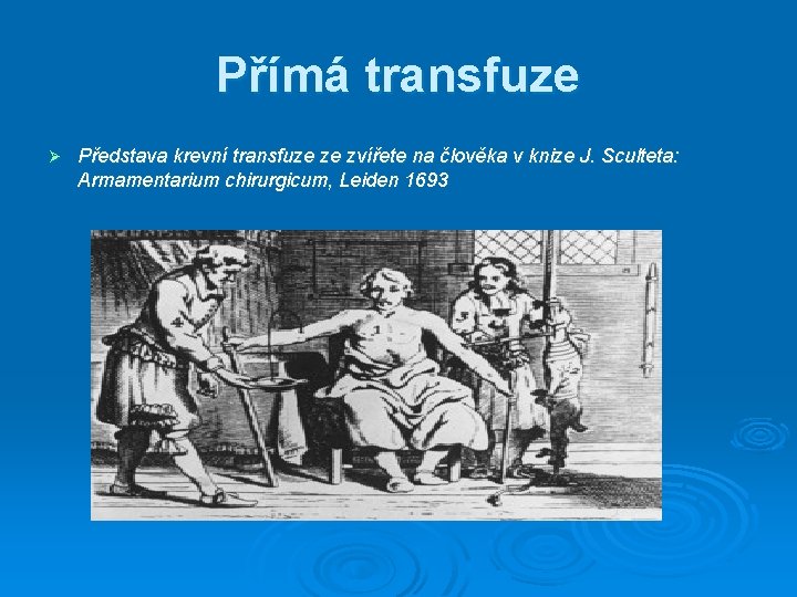 Přímá transfuze Ø Představa krevní transfuze ze zvířete na člověka v knize J. Sculteta: Přímá transfuze Ø Představa krevní transfuze ze zvířete na člověka v knize J. Sculteta: