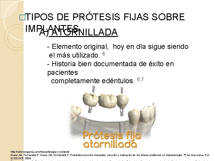�TIPOS DE PRÓTESIS FIJAS SOBRE IMPLANTES A) ATORNILLADA - Elemento original, hoy en día