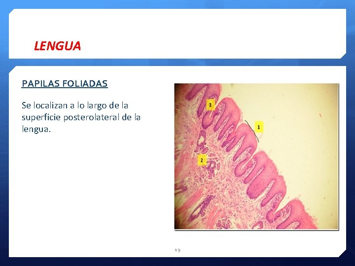 LENGUA PAPILAS FOLIADAS Se localizan a lo largo de la superficie posterolateral de la
