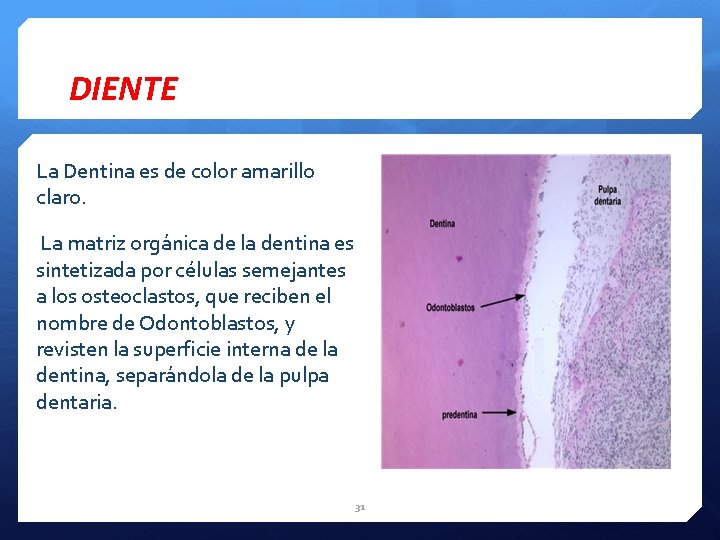 DIENTE La Dentina es de color amarillo claro. La matriz orgánica de la dentina