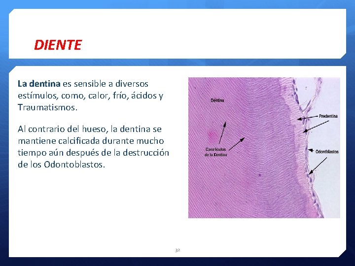 DIENTE La dentina es sensible a diversos estímulos, como, calor, frío, ácidos y Traumatismos.