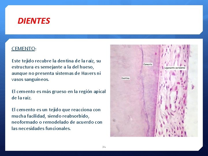 DIENTES CEMENTO: Este tejido recubre la dentina de la raíz, su estructura es semejante