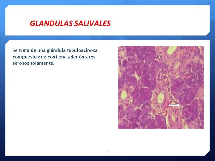 GLANDULAS SALIVALES Se trata de una glándula tubuloacinosa compuesta que contiene adenómeros serosos solamente.