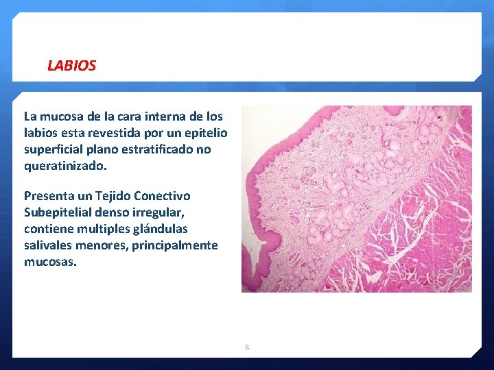 LABIOS La mucosa de la cara interna de los labios esta revestida por un