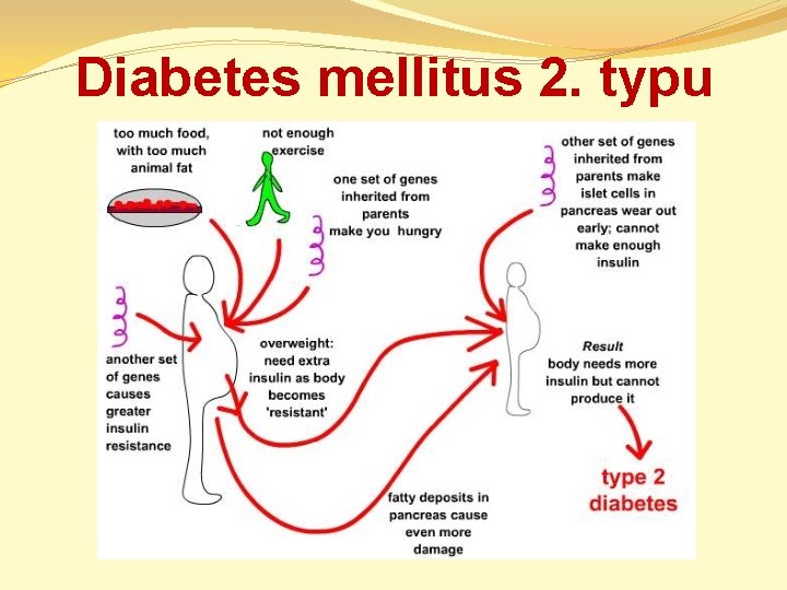 diabetes mellitus 2 typu)