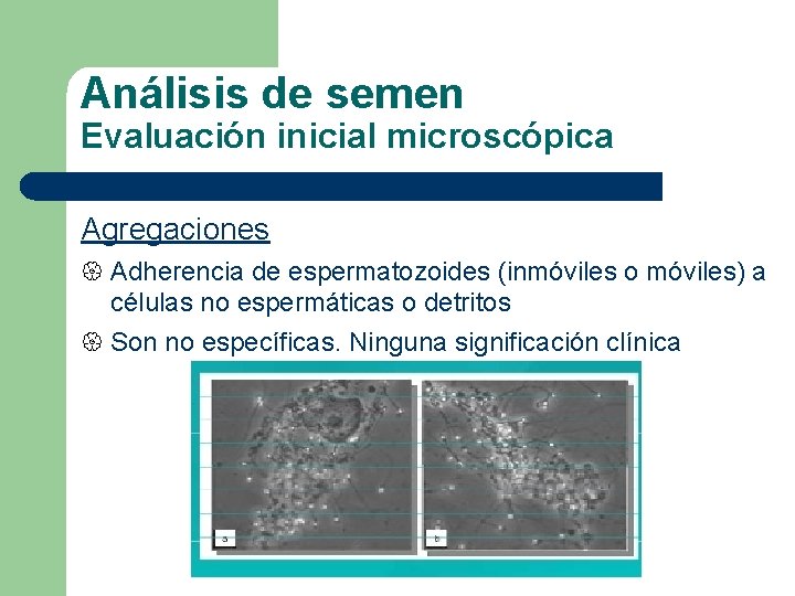 Análisis de semen Evaluación inicial microscópica Agregaciones { Adherencia de espermatozoides (inmóviles o móviles)
