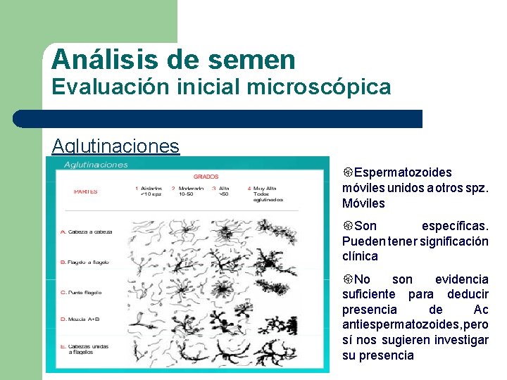 Análisis de semen Evaluación inicial microscópica Aglutinaciones {Espermatozoides móviles unidos a otros spz. Móviles