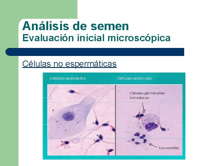 Análisis de semen Evaluación inicial microscópica Células no espermáticas 