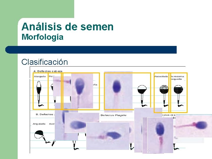 Análisis de semen Morfología Clasificación 