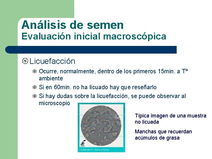 Análisis de semen Evaluación inicial macroscópica { Licuefacción Ocurre, normalmente, dentro de los primeros