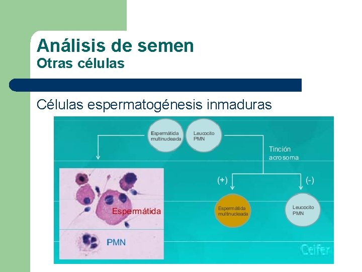 Análisis de semen Otras células Células espermatogénesis inmaduras 