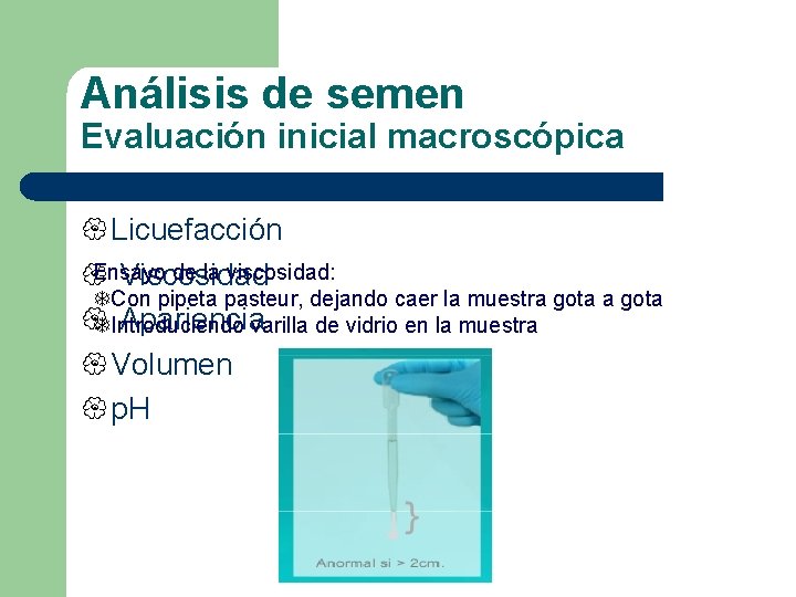 Análisis de semen Evaluación inicial macroscópica { Licuefacción Ensayo de la viscosidad: { Viscosidad