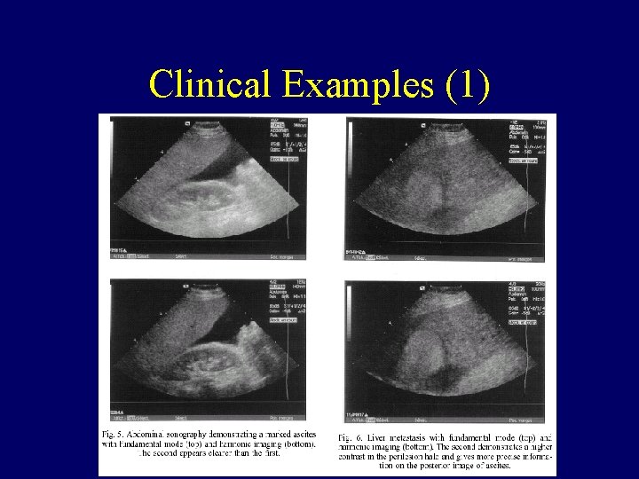 Clinical Examples (1) 