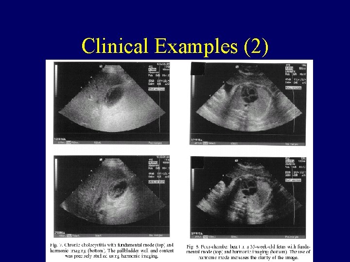 Clinical Examples (2) Clinical Examples (2)