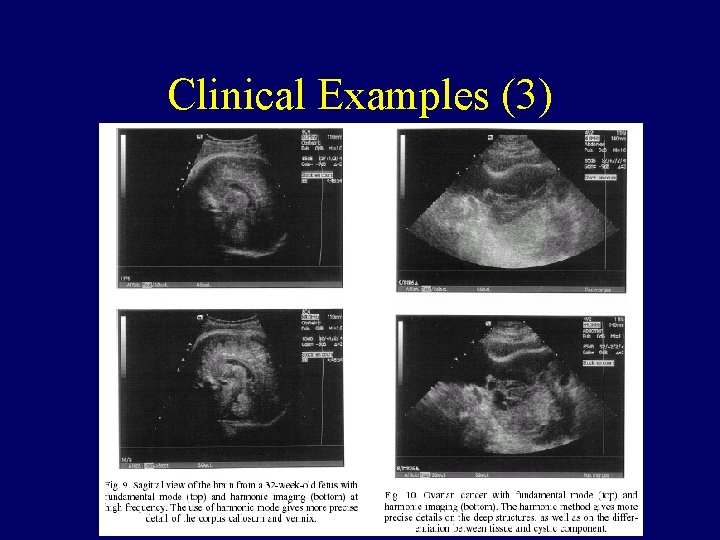 Clinical Examples (3) Clinical Examples (3)