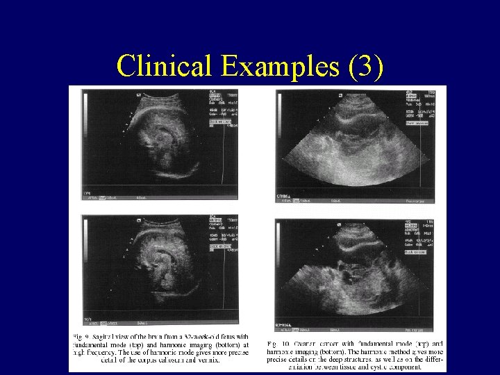 Clinical Examples (3) 