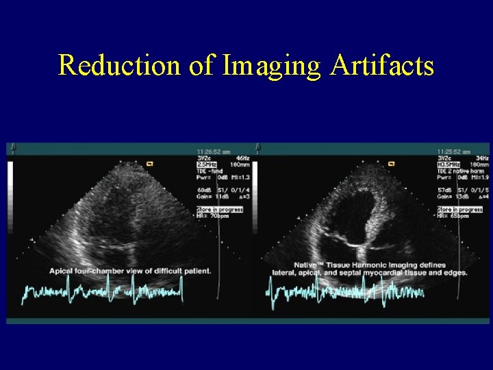 Reduction of Imaging Artifacts Reduction of Imaging Artifacts