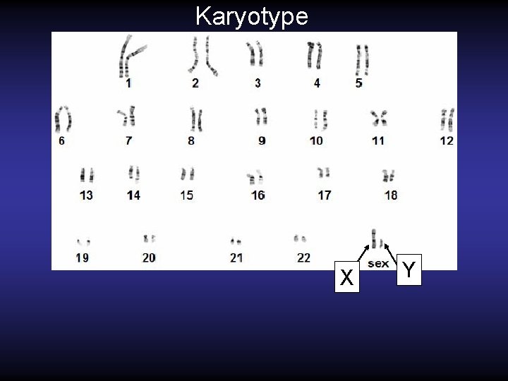 Karyotype X Y 