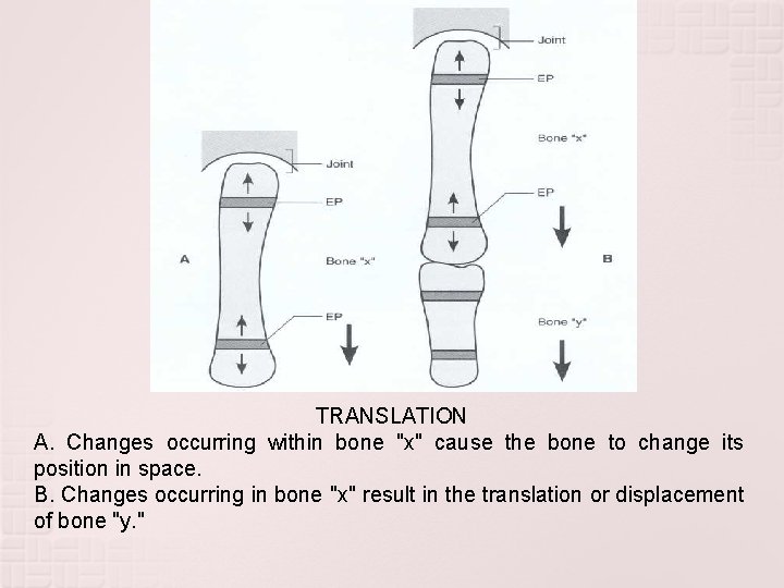 TRANSLATION A. Changes occurring within bone "x" cause the bone to change its position TRANSLATION A. Changes occurring within bone "x" cause the bone to change its position