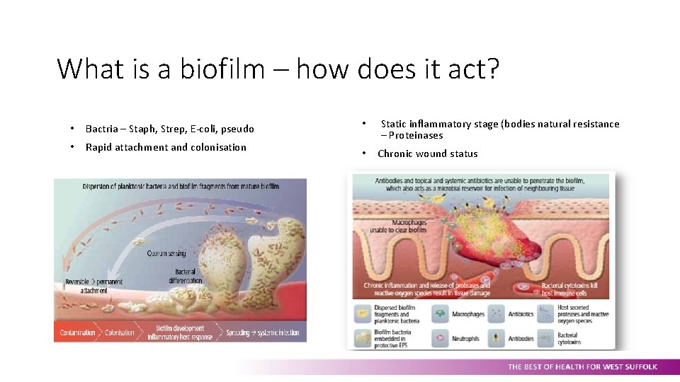 What is a biofilm – how does it act? • Bactria – Staph, Strep,