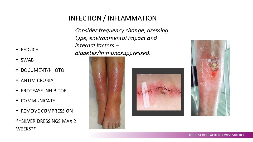 INFECTION / INFLAMMATION • REDUCE • SWAB Consider frequency change, dressing type, environmental impact