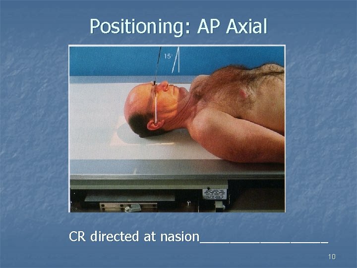Positioning: AP Axial CR directed at nasion_________ 10 