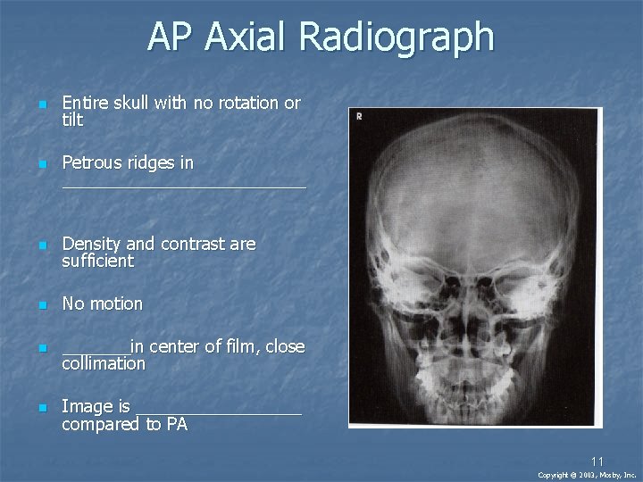 AP Axial Radiograph n Entire skull with no rotation or tilt n Petrous ridges