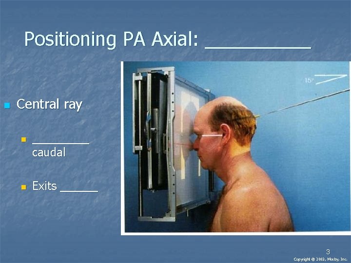 Positioning PA Axial: _____ n Central ray n n _____ caudal Exits ______ 3