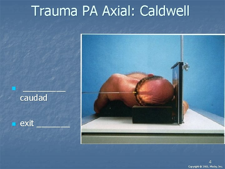 Trauma PA Axial: Caldwell n n _____ caudad exit _______ 4 Copyright © 2003,