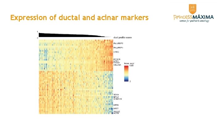 Expression of ductal and acinar markers Expression of ductal and acinar markers